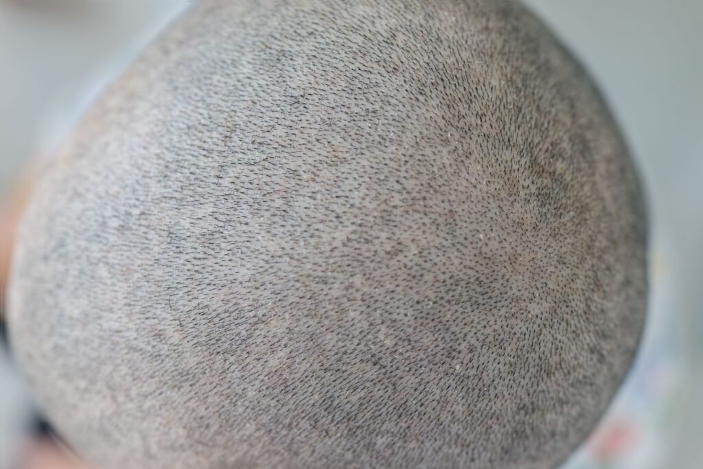 Cabeça raspada em zoom.