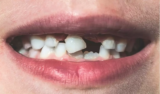Sonhar com dente caindo: da boca, no chão, na mão, com sangue e mais!