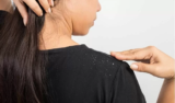 Sonhar com caspa: na cabeça, no corpo, na roupa, na cama, no chão e mais!