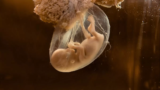 Sonhar com feto: vivo, morto, na barriga, se mexendo, um aborto e mais!